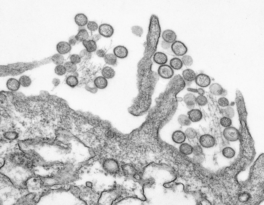 Two Britons Recovering After Hantavirus Cruise Ship Evacuation in 2026 본문 이미지
